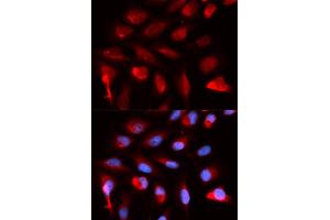 Immunofluorescence analysis of U2OS cells using PPARD antibody. (PPARD antibody)