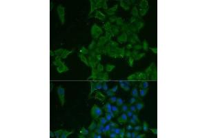 Immunofluorescence analysis of MCF7 cells using LGALS3BP Polyclonal Antibody (LGALS3BP antibody)