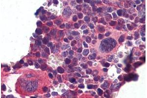 Mouse Lymphoid Tissue: Formalin-Fixed, Paraffin-Embedded (FFPE) (KLF2 antibody  (N-Term))