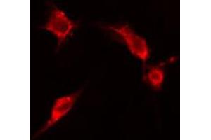 ABIN6266602 staining HepG2 cells by IF/ICC. (ENO2/NSE antibody  (C-Term))