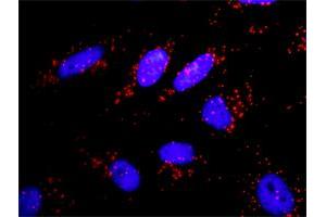 Proximity Ligation Analysis of protein-protein interactions between APPL1 and PIK3CA. (PIK3CA antibody  (AA 959-1068))