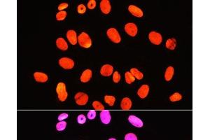Immunofluorescence analysis of U-2 OS cells using Symmetric DiMethyl-Histone H3-R2 Polyclonal Antibody at dilution of 1:100 (40x lens). (Histone 3 antibody  (H3R2me2s))