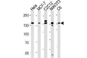Lane 1: HeLa Cell lysates, Lane 2: MCF-7 Cell lysates, Lane 3: C2C12 Cell lysates, Lane 4: NIH/3T3 Cell lysates, Lane 5: C6 Cell lysates, probed with RPTOR (1411CT316. (Raptor antibody)