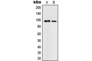 Western blot analysis of PML expression in K562 (A), COLO320 (B) whole cell lysates.