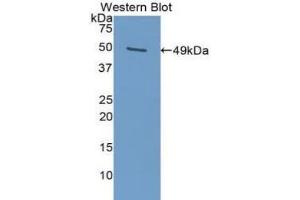 Western blot analysis of the recombinant protein. (PAI1 antibody  (AA 25-402))