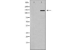 Western blot analysis of MDR1 using HT-29 whole cell lysates,The lane on the left is treated with the antigen-specific peptide. (ABCB1 antibody  (Internal Region))