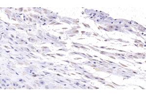 Detection of DSG3 in Human Placenta Tissue using Monoclonal Antibody to Desmoglein 3 (DSG3) (Desmoglein 3 antibody  (AA 334-604))