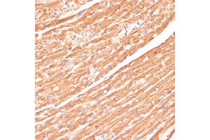 Immunohistochemistry of paraffin-embedded mouse heart using CYB5A antibody (ABIN6130832, ABIN6139296, ABIN6139297 and ABIN6221049) at dilution of 1:100 (40x lens). (CYB5A antibody  (AA 1-100))