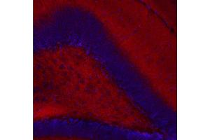 Indirect immunostaining of a PFA fixed mouse hippocampus section (dilution 1 : 200, red). (CASKIN1 antibody)