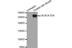 Western blot analysis of extracts from 293 cells using Phospho-ACACA-S79 antibody. (Acetyl-CoA Carboxylase alpha antibody  (pSer79))