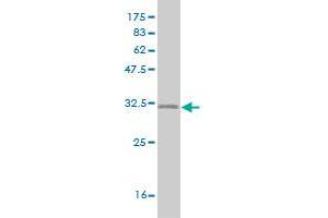 Western Blotting (WB) image for anti-Splicing Factor 3b, Subunit 2, 145kDa (SF3B2) (AA 592-645) antibody (ABIN564766)