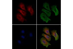 ABIN6261612 and ABIN6279424 staining Hela cells by IF/ICC. (ETAA1 antibody  (Internal Region))