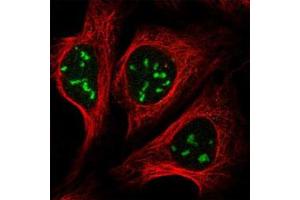 Immunofluorescent staining of human cell line U-2 OS with TBL3 polyclonal antibody  at 1-4 ug/mL dilution shows positivity in nucleus and nucleoli.