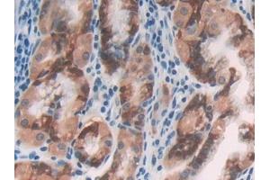 Detection of CILP in Human Stomach Tissue using Polyclonal Antibody to Cartilage Intermediate Layer Protein (CILP)