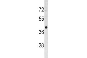 Western blot analysis of TROP2 antibody and HL-60 lysate. (TACSTD2 antibody  (AA 162-190))