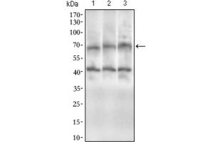 Western blot analysis using ABCG5 antibody against HepG2 (1), HeLa (2), and Jurkat (3) cell lysate. (ABCG5 antibody  (AA 306-367))