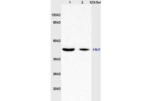 Lane 1: rat brain lysates Lane 2: human colon carcinoma lysates probed with Anti WNT7A Polyclonal Antibody, Unconjugated (ABIN719336) at 1:200 in 4 °C. (WNT7A antibody  (AA 241-349))