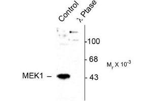 Image no. 1 for anti-Mitogen-Activated Protein Kinase Kinase 1 (MAP2K1) (pThr386) antibody (ABIN372666) (MEK1 antibody  (pThr386))