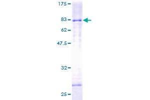 Image no. 1 for Histone Deacetylase 3 (HDAC3) (AA 1-428) protein (GST tag) (ABIN1306448) (HDAC3 Protein (AA 1-428) (GST tag))