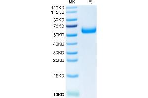 Human TREM2 on Tris-Bis PAGE under reduced condition. (TREM2 Protein (AA 19-174) (Fc Tag))