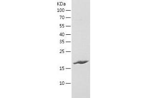 Western Blotting (WB) image for Immunoglobulin Superfamily Containing Leucine Rich Repeat Protein (ISLR) (AA 111-275) protein (His tag) (ABIN7284279) (ISLR Protein (AA 111-275) (His tag))