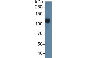Detection of C5a in Porcine Serum using Polyclonal Antibody to Complement Component 5a (C5a) (C5A antibody  (AA 1-74))