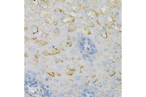 Immunohistochemistry of paraffin-embedded human esophagus using COX4I1 Antibody (ABIN2561975) at dilution of 1:100 (40x lens). (COX IV antibody)