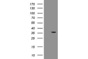 HEK293T cells were transfected with the pCMV6-ENTRY control (Left lane) or pCMV6-ENTRY RFC2 (Right lane) cDNA for 48 hrs and lysed. (RFC2 antibody)