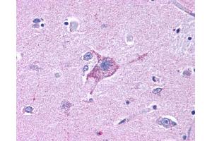 Anti-NPY5R antibody IHC of human brain, neurons and glia. (NPY5R antibody  (Cytoplasmic Domain))