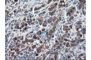 Image no. 5 for anti-Ribophorin 1 (RPN1) antibody (ABIN1500748)