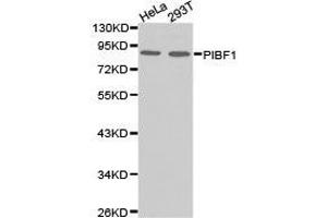 Western Blotting (WB) image for anti-Progesterone Immunomodulatory Binding Factor 1 (PIBF1) antibody (ABIN1874123) (PIBF1 antibody)