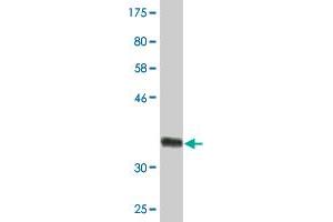 Western Blot detection against Immunogen (35. (HSD3B2 antibody  (AA 33-122))