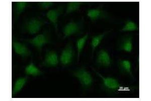 Immunostaining analysis in HeLa cells. (SMAD1 antibody)