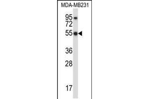 Western blot analysis in MDA-MB231 cell line lysates (35ug/lane). (HCLS1 antibody  (C-Term))