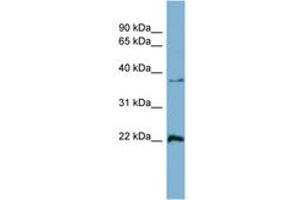 Image no. 1 for anti-RAN, Member RAS Oncogene Family (RAN) (AA 143-192) antibody (ABIN6741892) (RAN antibody  (AA 143-192))