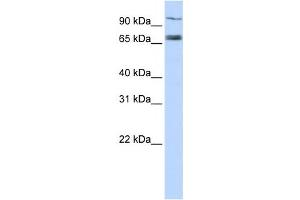 Western Blotting (WB) image for anti-Transporter 1, ATP-Binding Cassette, Sub-Family B (MDR/TAP) (TAP1) antibody (ABIN2458765) (TAP1 antibody)