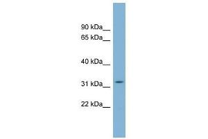 C22orf31 antibody used at 0. (C22orf31 antibody  (Middle Region))