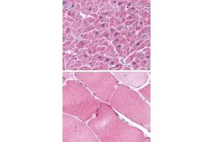 1st Below: Immunohistochemistry of ARC in human heart tissue at 5 μg/ml. (NOL3 antibody  (C-Term))