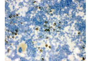 Immunohistochemistry (IHC) image for anti-Lipocalin 2 (LCN2) (AA 21-200) antibody (ABIN3043290)