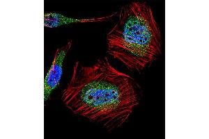 Fluorescent confocal image of Hela cell stained with MLLT10 (AF10) Antibody (Center) (ABIN1882102 and ABIN2850420). (MLLT10 antibody  (AA 294-323))