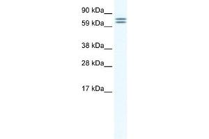 CES6 antibody (20R-1163) used at 0. (CES4A antibody  (Middle Region))