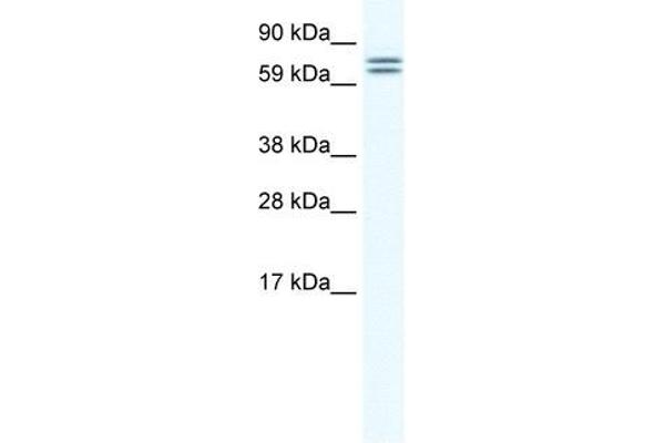 CES4A antibody  (Middle Region)