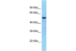 WB Suggested Anti-Gal3st4 Antibody Titration: 1.