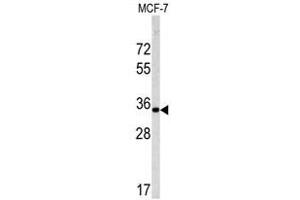 Image no. 1 for anti-Emerin (EMD) (C-Term) antibody (ABIN452956)