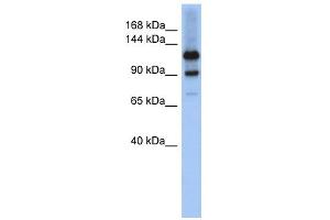 WB Suggested Anti-HIPK1 Antibody Titration: 0. (HIPK1 antibody  (Middle Region))