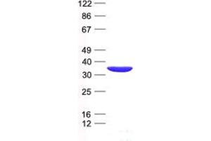 Validation with Western Blot (PSMA1 Protein (His tag))