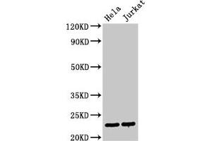 Western Blot Positive WB detected in: Hela whole cell lysate, Jurkat whole cell lysate All lanes: PTTG1 antibody at 3 μg/mL Secondary Goat polyclonal to rabbit IgG at 1/50000 dilution Predicted band size: 23 kDa Observed band size: 23 kDa (PTTG1 antibody  (AA 2-202))