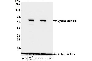 Western Blotting (WB) image for anti-Keratin 5/6 (KRT5/6) (C-Term) antibody (ABIN7795769) (Recombinant Keratin 5/6 antibody  (C-Term))