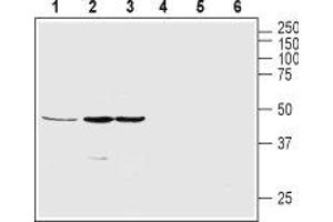 Western blot analysis of rat pancreas (lanes 1 and 4), SH-SY5Y (lanes 2 and 5) and MS1 (lanes 3 and 6) lysates: - 1-3. (GHSR antibody  (2nd Extracellular Loop))