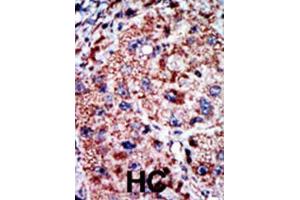 Immunohistochemistry (IHC) image for anti-Phosphofructokinase, Liver (PFKL) antibody (ABIN3003704) (PFKL antibody)